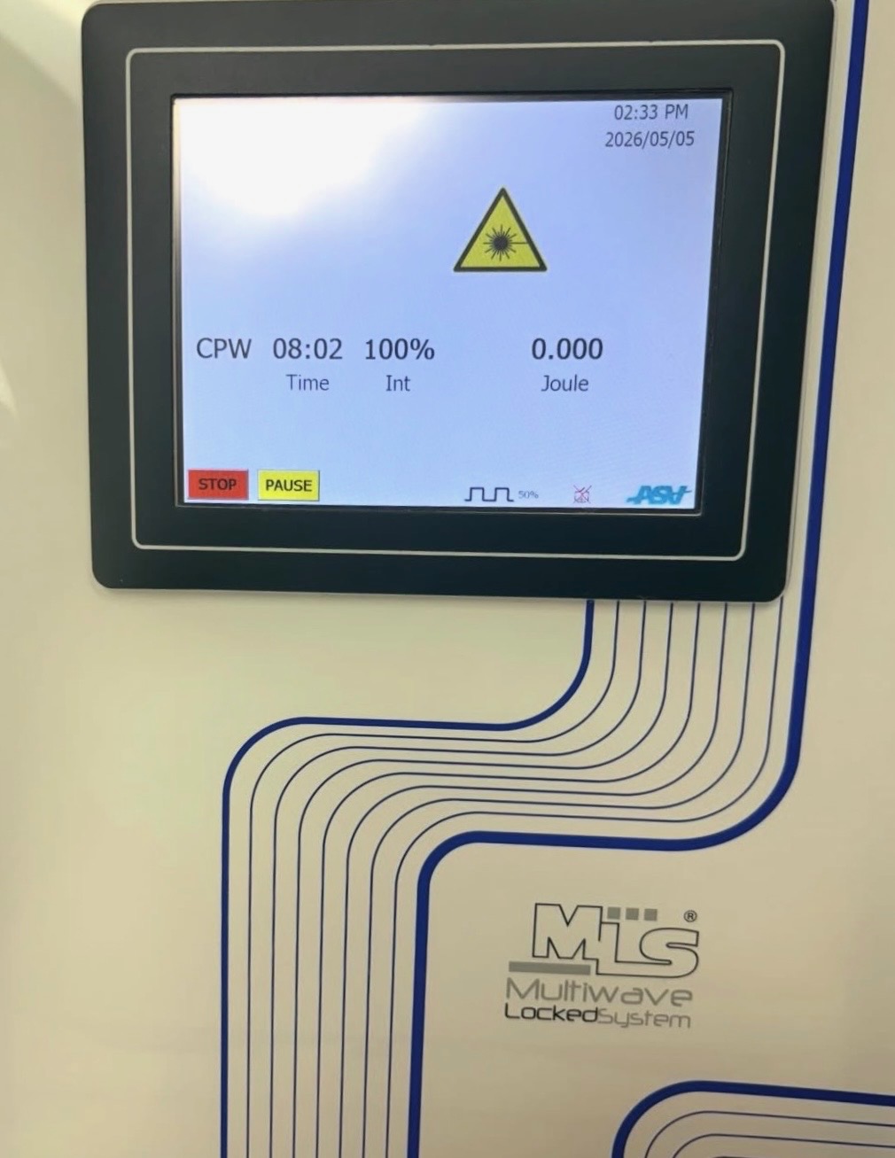 The MLS® Laser Therapy unit standing in a Metro Foot & Ankle treatment room, showing its control panel and the manufacturer name on the housing.