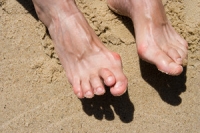 Managing Hammertoe